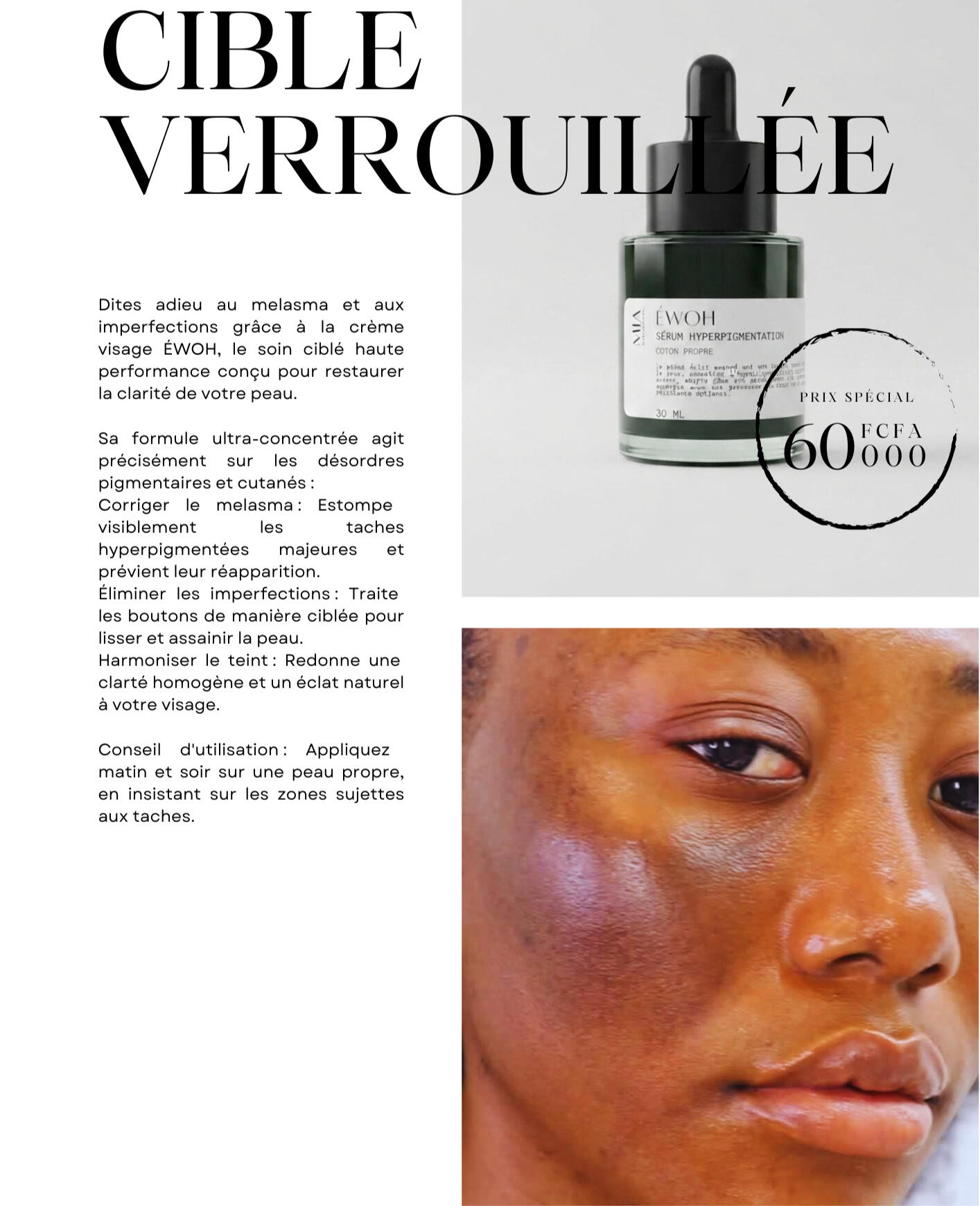 SERUM MIA Institut
